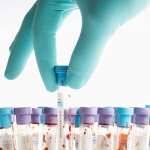 TN100PFB Series Class 100 (9.5") Cleanroom Gloves - 01 X-Small